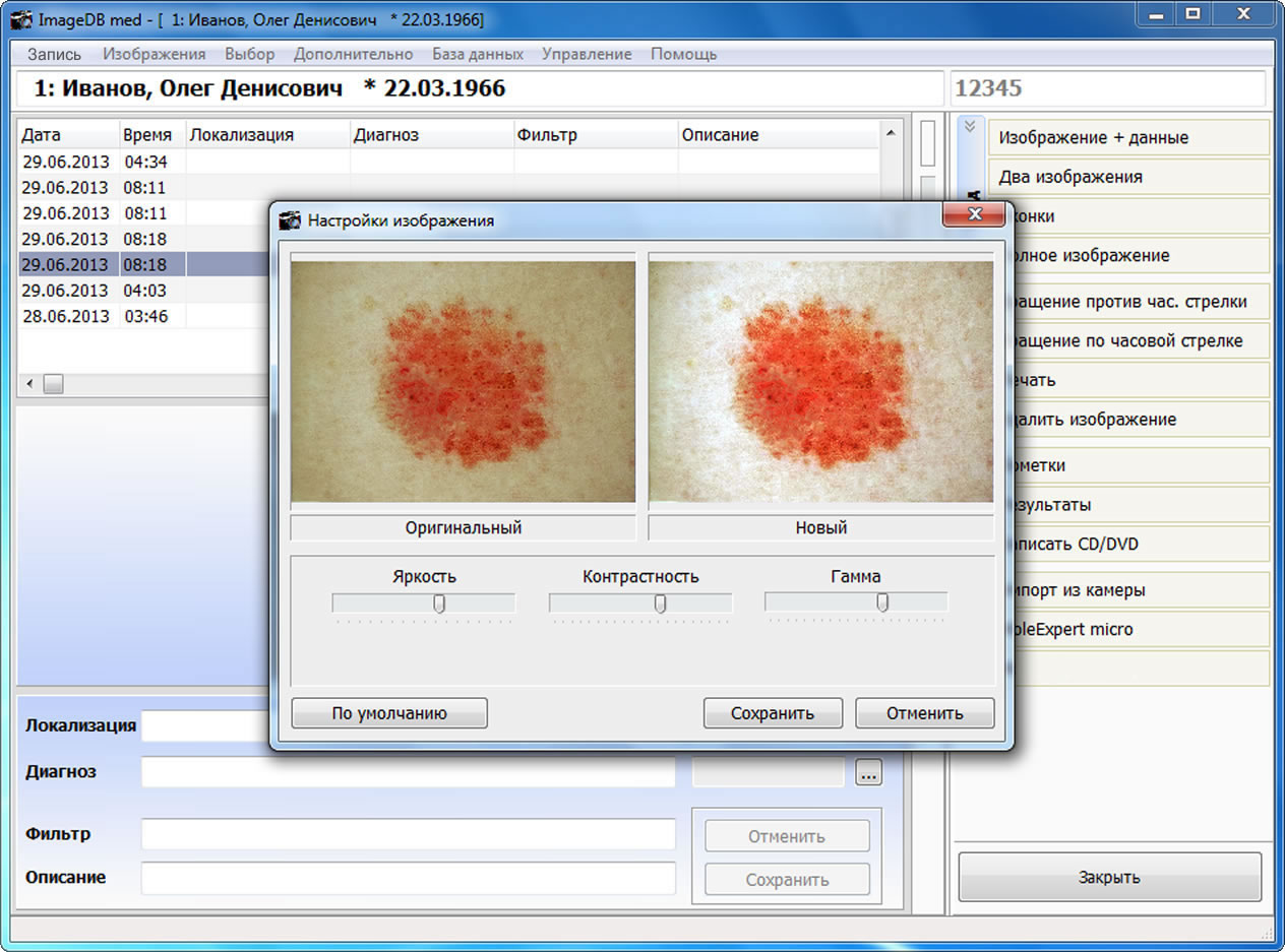 MoleExpert micro: окно базы данных Image DB med