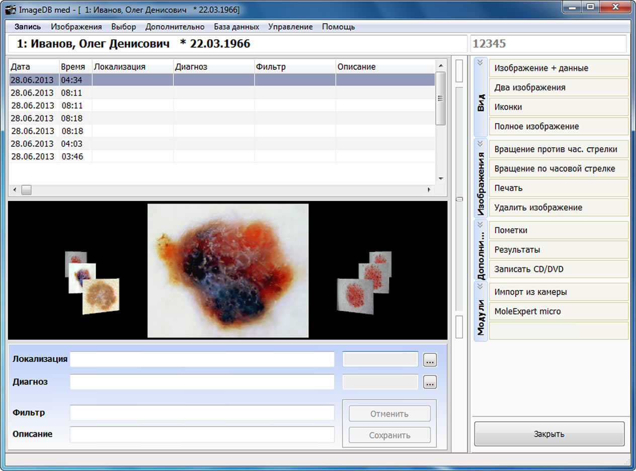MoleExpert micro: карусель активных иконок изображений